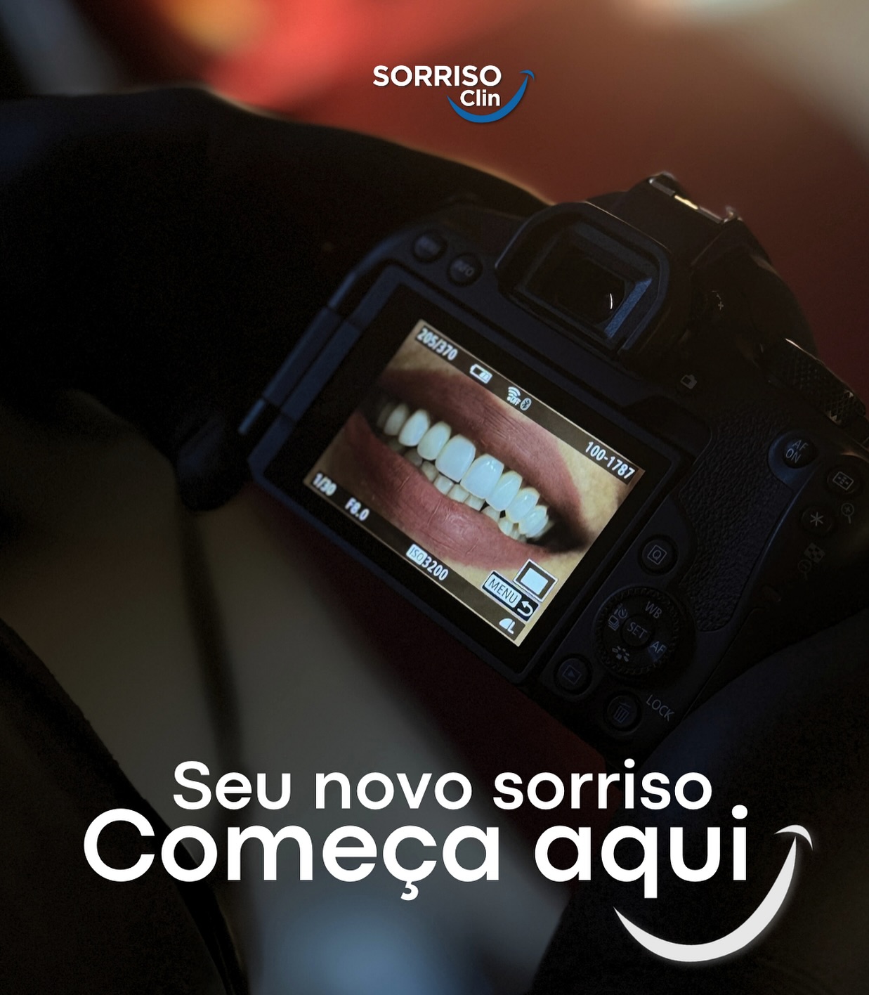 Câmera fotográfica registrando o sorriso de um paciente durante documentação odontológica